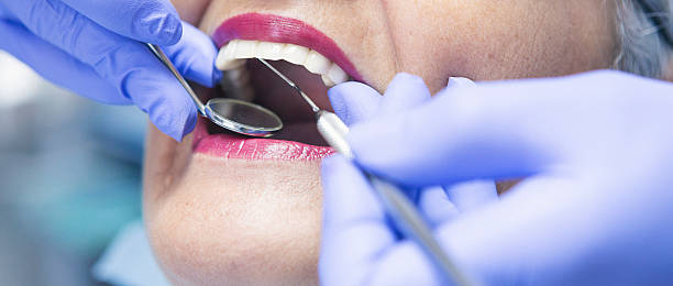 Best Emergency Broken Tooth Repair in Greenfield, MO